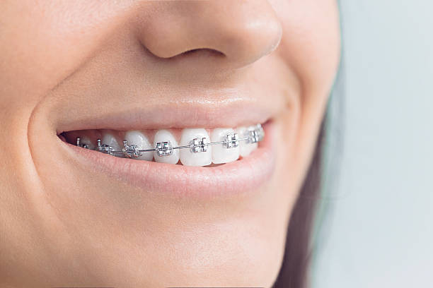 Laser Dentistry in Rosanky, TX